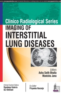 Bertrand.pt - Clinico Radiological Series: Imaging Of Interstitial Lung Diseases