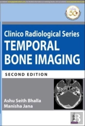 Clinico Radiological Series: Temporal Bone Imaging