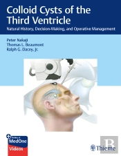 Colloid Cysts Of The Third Ventricle