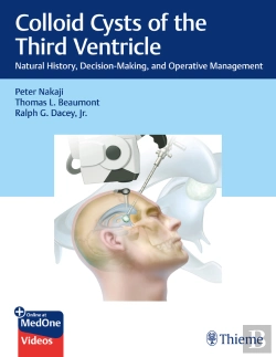 Bertrand.pt - Colloid Cysts Of The Third Ventricle