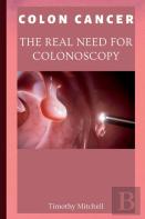 Colon Cancer