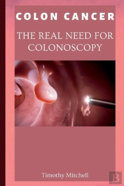 Bertrand.pt - Colon Cancer