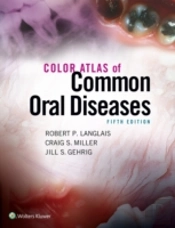 Color Atlas Common Oral Diseases 5e
