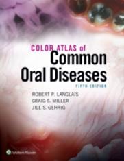 Color Atlas Common Oral Diseases 5e