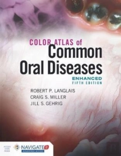 Bertrand.pt - Color Atlas Of Common Oral Diseases, Enhanced Edition