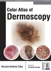 Color Atlas Of Dermoscopy