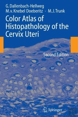 Bertrand.pt - Color Atlas Of Histopathology Of The Cervix Uteri
