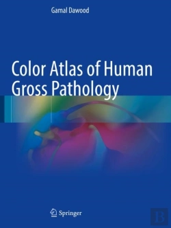 Bertrand.pt - Color Atlas Of Human Gross Pathology