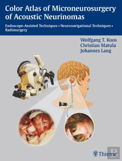 Bertrand.pt - Color Atlas Of Microsurgery Of Acoustic Neurinomas