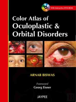 Bertrand.pt - Color Atlas Of Oculoplastic & Orbital Disorders