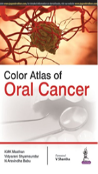 Color Atlas Of Oral Cancer