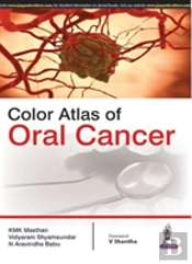 Color Atlas Of Oral Cancer