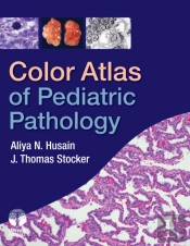 Color Atlas Of Pediatric Pathology
