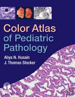 Bertrand.pt - Color Atlas Of Pediatric Pathology