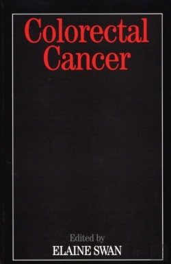 Bertrand.pt - Colorectal Cancer