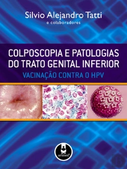 Bertrand.pt - Colposcopia e Patologias do Trato Genital Inferior