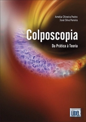 Colposcopia