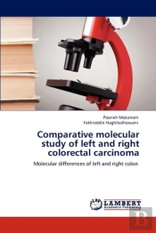 Comparative Molecular Study Of Left And Right Colorectal Carcinoma