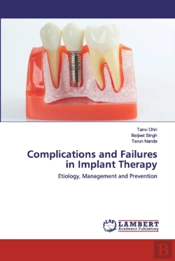 Bertrand.pt - Complications And Failures In Implant Therapy