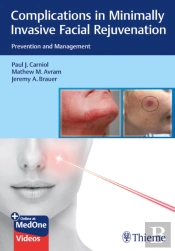 Complications In Minimally Invasive Facial Rejuvenation