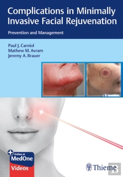 Bertrand.pt - Complications In Minimally Invasive Facial Rejuvenation