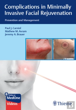 Bertrand.pt - Complications In Minimally Invasive Facial Rejuvenation