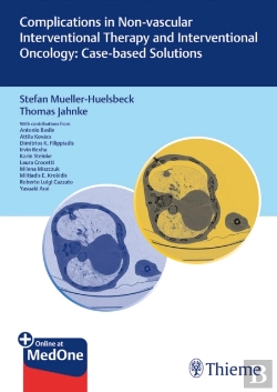 Bertrand.pt - Complications In Non-Vascular Interventional Therapy And Interventional Oncology: Case-Based Solutions