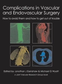 Bertrand.pt - Complications In Vascular And Endovascular Surgery