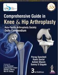 Comprehensive Guide In Knee & Hip Arthroplasty