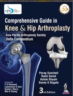 Bertrand.pt - Comprehensive Guide In Knee & Hip Arthroplasty