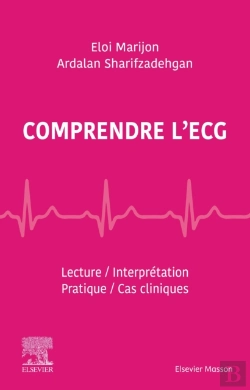 Bertrand.pt - Comprendre L'Ecg