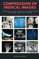 Compression Of Medical Images - Lossless High Quality Image Data Storage And Retrieval
