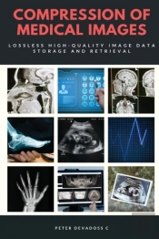 Compression Of Medical Images - Lossless High Quality Image Data Storage And Retrieval