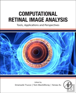 Bertrand.pt - Computational Retinal Image Analysis