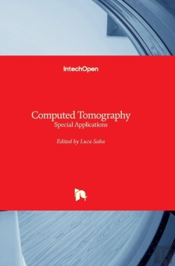 Bertrand.pt - Computed Tomography