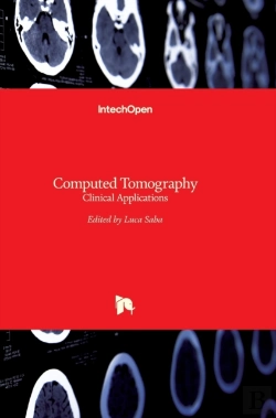 Bertrand.pt - Computed Tomography