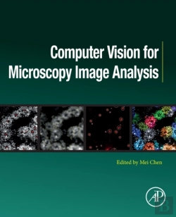 Bertrand.pt - Computer Vision For Microscopy Image Analysis