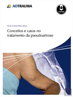 Bertrand.pt - Conceitos e Casos no Tratamento da Pseudoartrose