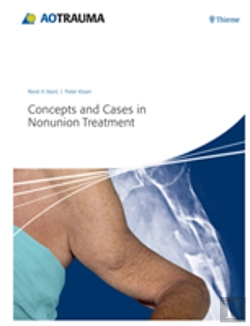 Bertrand.pt - Concepts And Cases In Nonunion Treatment