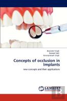 Concepts Of Occlusion In Implants