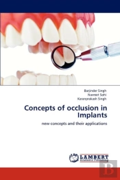 Concepts Of Occlusion In Implants