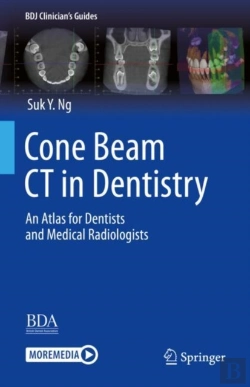 Bertrand.pt - Cone Beam Ct In Dentistry