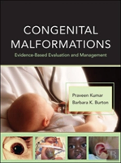Bertrand.pt - Congenital Malformations
