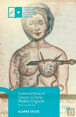 Bertrand.pt - Constructions Of Cancer In Early Modern England