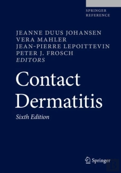 Bertrand.pt - Contact Dermatitis