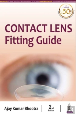 Bertrand.pt - Contact Lens: Fitting Guide