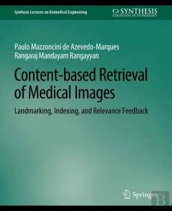 Bertrand.pt - Content-Based Retrieval Of Medical Images