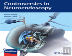 Controversies In Neuroendoscopy