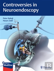Controversies In Neuroendoscopy