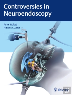 Bertrand.pt - Controversies In Neuroendoscopy